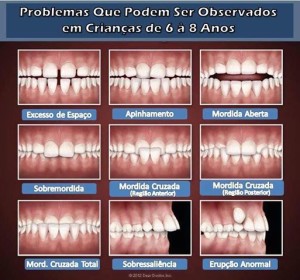 problemas_ortodonticos